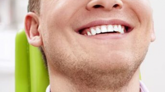 All You Need to Know About Dental Implants