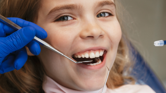 Dental Sealants to Protect Pits and Fissures on Molars