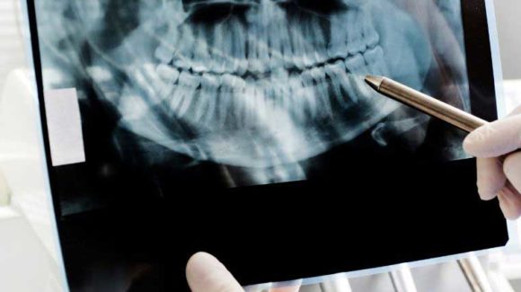 Dental Radiography – What Is It And What Is It Used For?