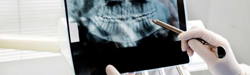 Dental Radiography – What Is It And What Is It Used For?