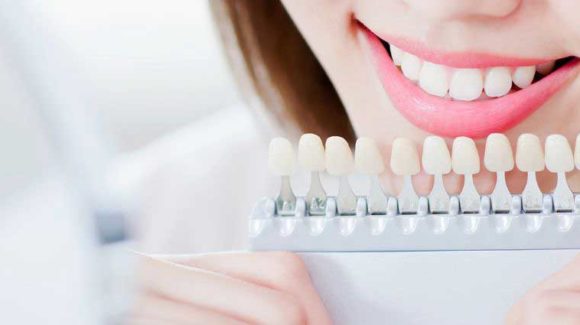 Teeth Whitening: Are Whiter Teeth Healthier?