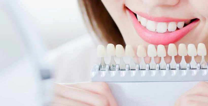 Teeth Whitening: Are Whiter Teeth Healthier?