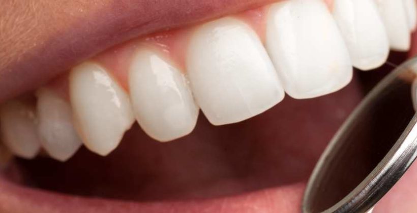 Cosmetic dentistry Crown and bridge Cavity symptoms Dental crowns and bridges COVID 19