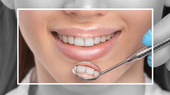 Dental Crowns and Bridges Procedure – What Can I Expect?