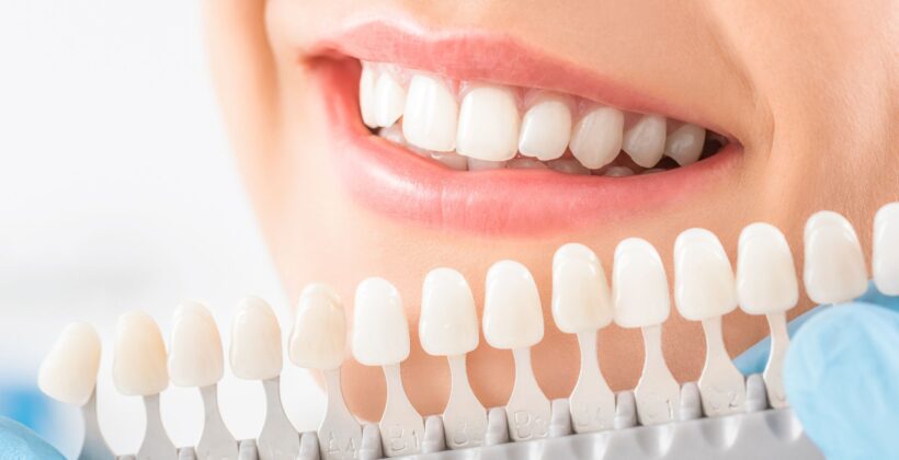 Woman at dentist office with whitening options - Midland Bay Dental.